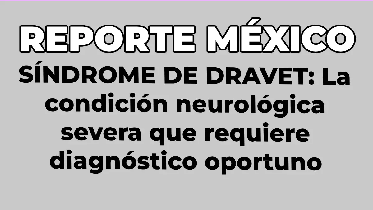 SÍNDROME DE DRAVET: La condición neurológica severa que requiere diagnóstico oportuno